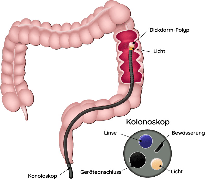 Koloskopie Gastroskopie Und Rektoskopie Dr Sonja Nakhai In Maria 